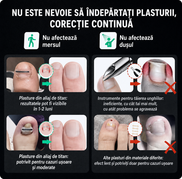 Kit Corector pentru Unghii Încarnate